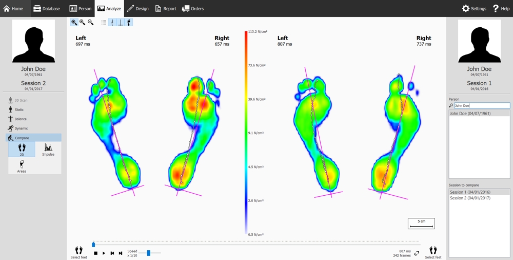 Example of computer digital display comparing two difference scan sessions from the Footscan advanced gait analysis system. The main focus of the image is two sets of highly coloured foot prints, showing pressure point maps of the patients feet with areas coloured in green, blue, yellow and red. Illustrating the footscan advanced gait analysis scanning system available at The Lomond Clinic, Helensburgh.
