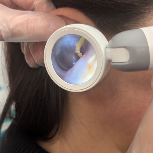 ear wax removal nurse Anna Blackshaw using a digital otoscope to examine inside a patient's ear at The Lomond Clinic